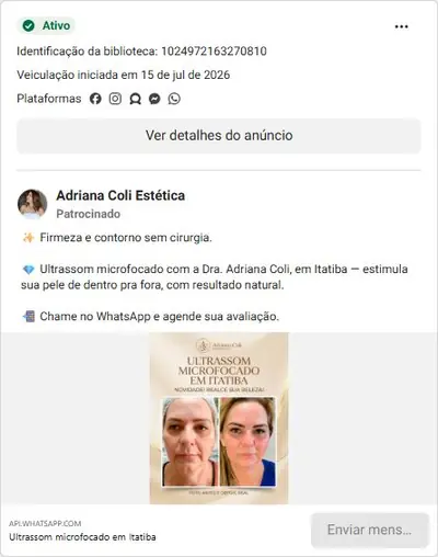 Anúncio de Adriana Coli Estética: Blefaroplastia com Laser CO2 Hybrid sem cortes